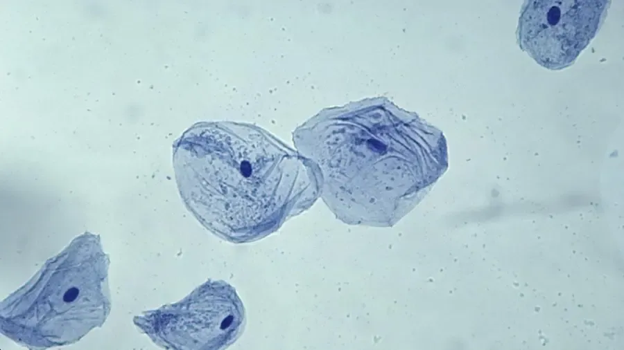 Vad är den allmänna formen på en kindcell?' title='Vad är den allmänna formen på en kindcell?